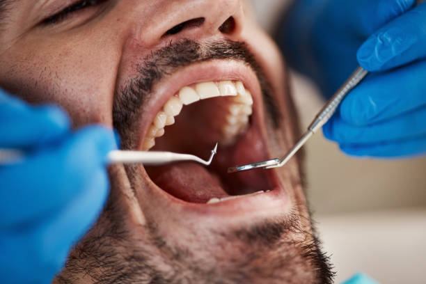Best Full Mouth Reconstruction  in Geneva, IN