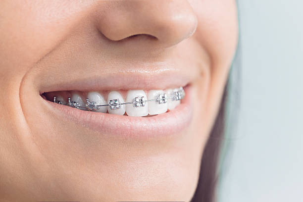 Best Dental Fillings (Composite and Amalgam)  in Geneva, IN